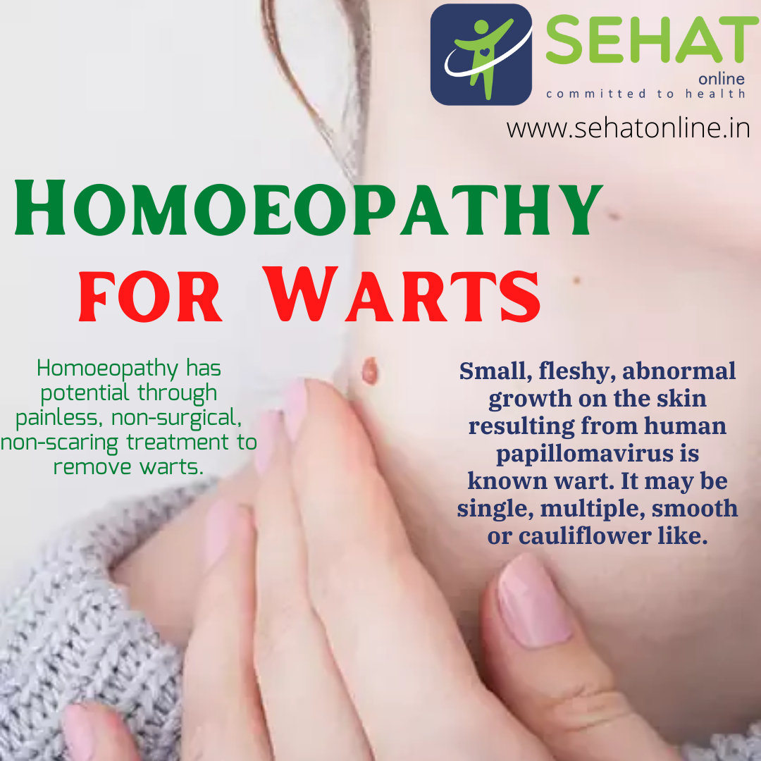 Homoeopathy For Warts Sehat 